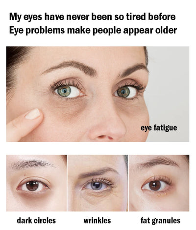 24K Gold Collagen Eye Mask for Dark Circles and Puffiness - Smarsty