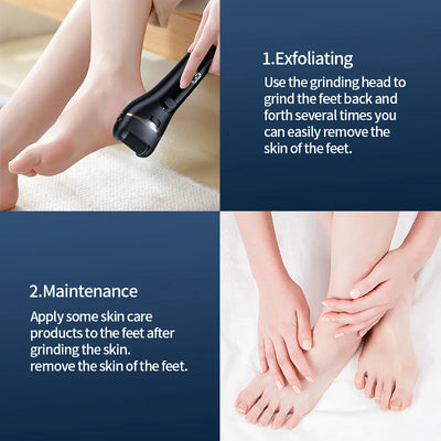 Rechargeable Electric Foot Grinder - USB Powered Callus Remover with Adjustable Speeds, for Men & Women's Pedicure and Self-Care - Smarsty