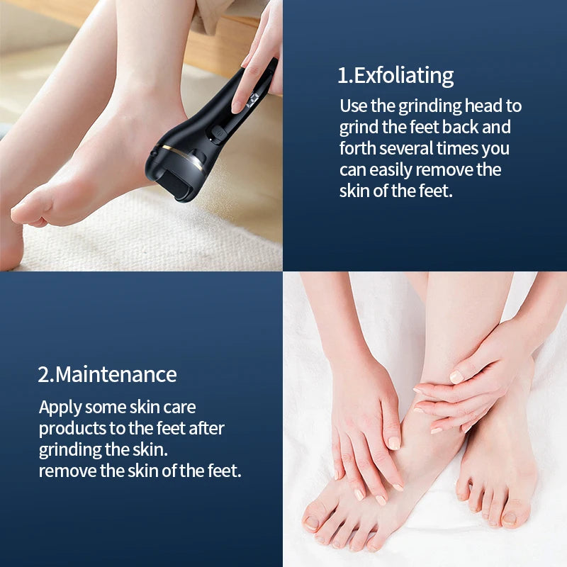 Rechargeable Electric Foot Grinder - USB Powered Callus Remover with Adjustable Speeds, for Men & Women's Pedicure and Self-Care - Smarsty