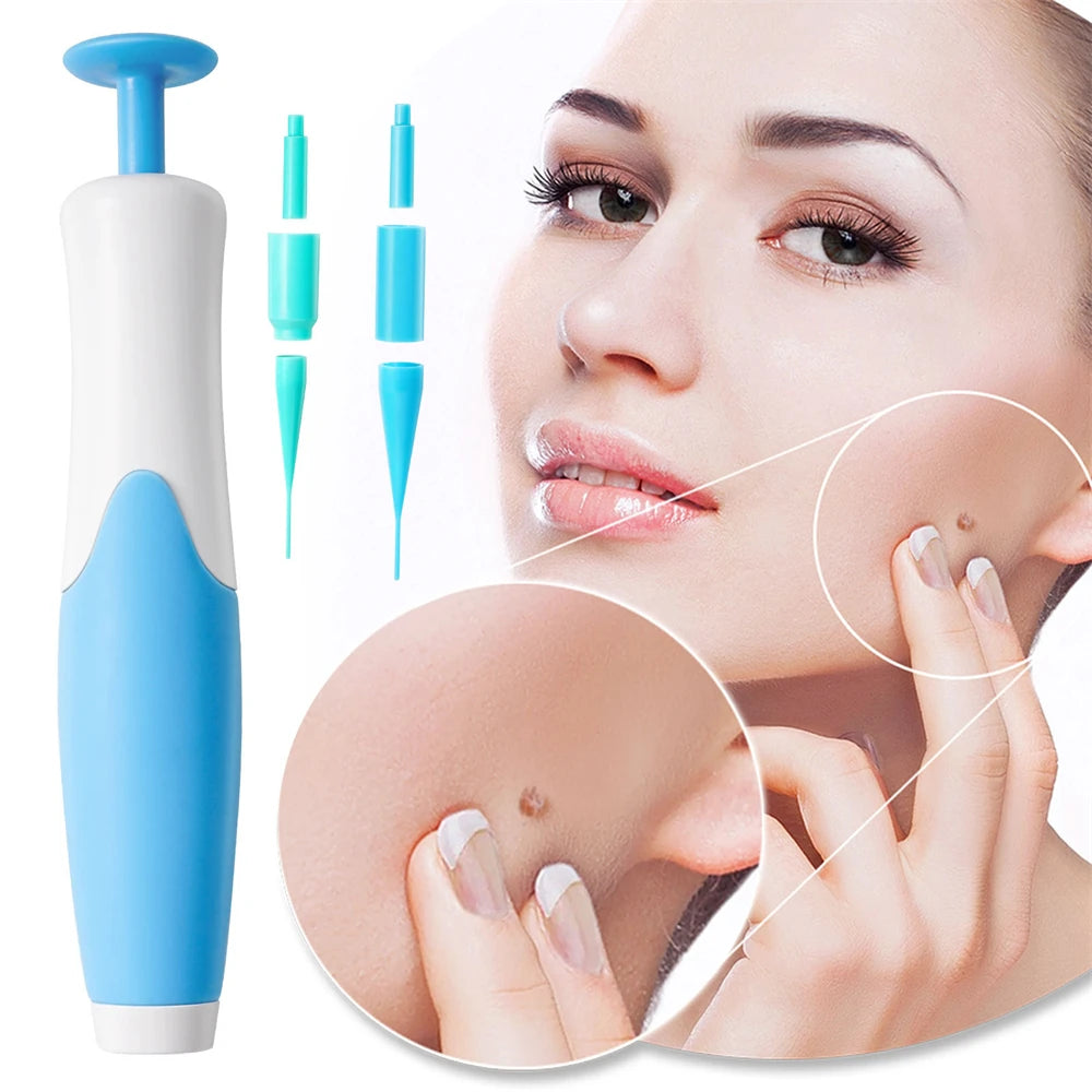 2 In 1 Painless Skin Tag Removal Kit for Face and Body - Smarsty