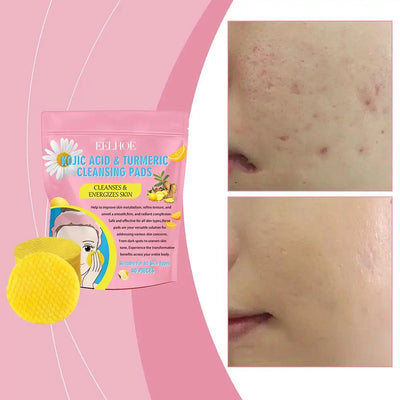 Turmeric Kojic Acid Exfoliating Cleansing Pads Combo - Smarsty