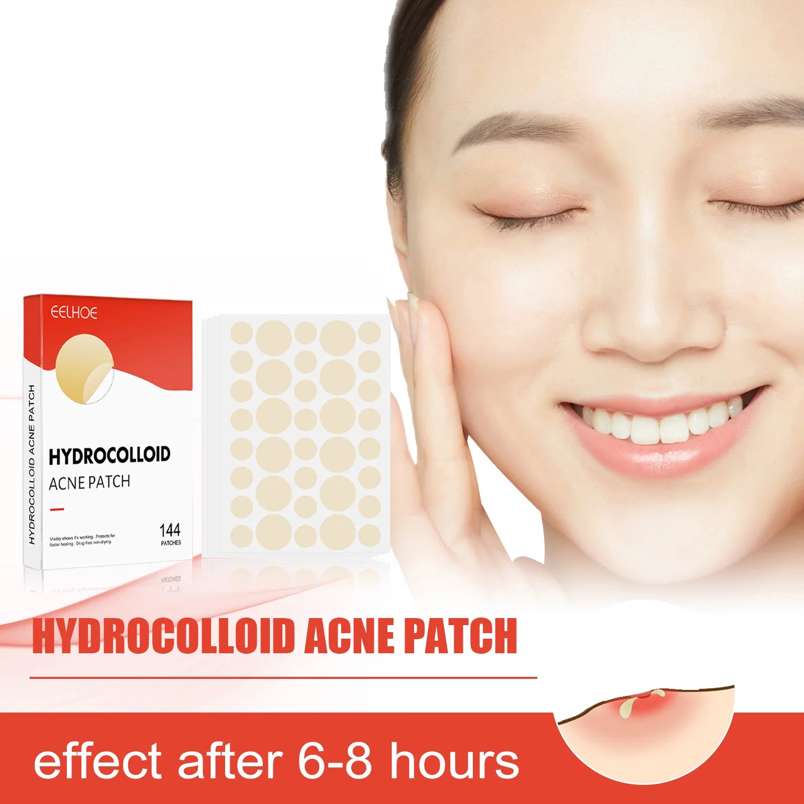 Invisible Hydrocolloid Acne Patches for Clear Skin - Smarsty