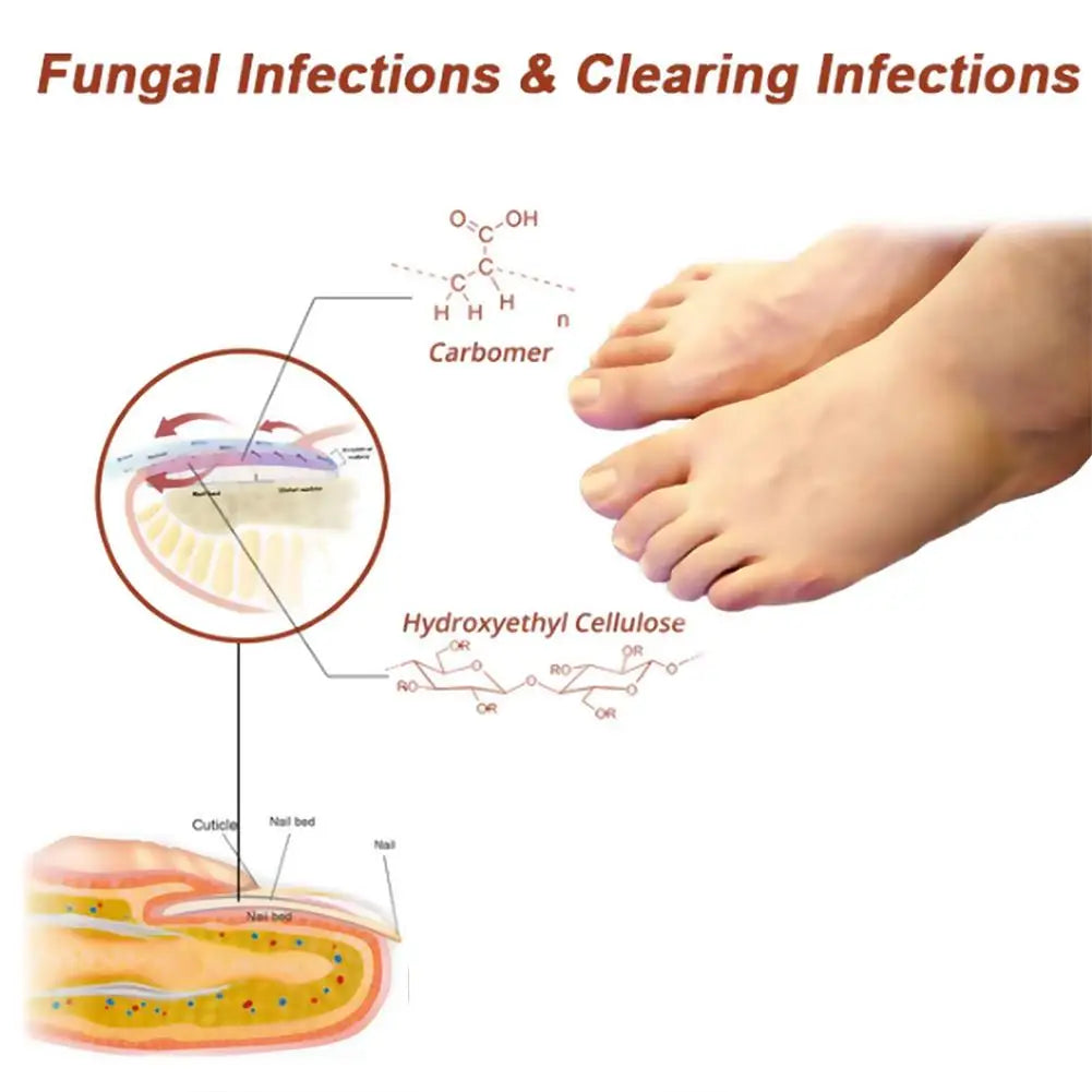 Nail Care Device for Fungal Treatment and Repair - Smarsty