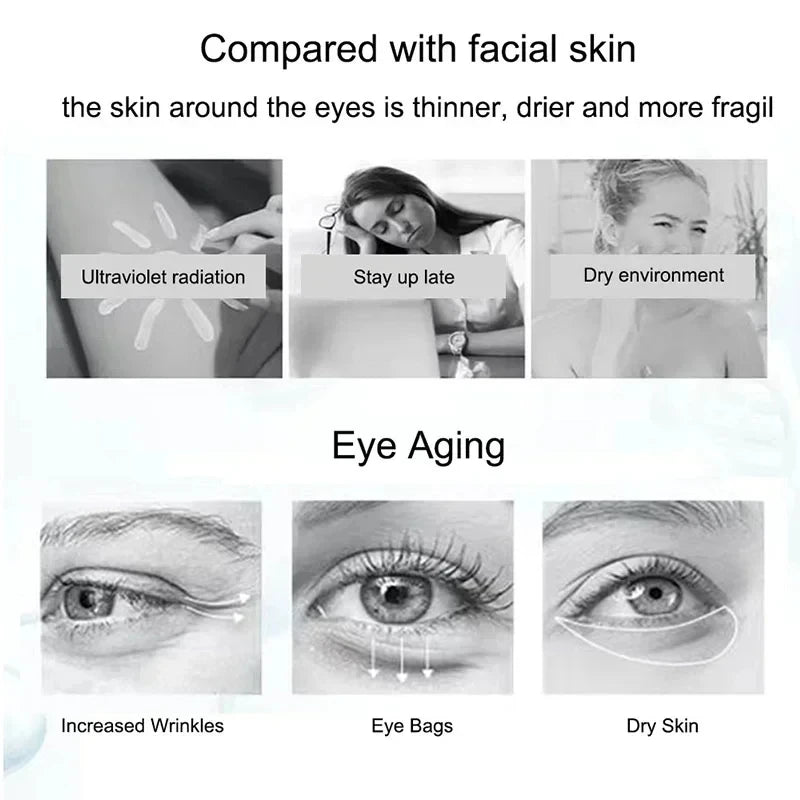 Nicotinamide Eye Cream for Dark Circles and Puffiness - Smarsty