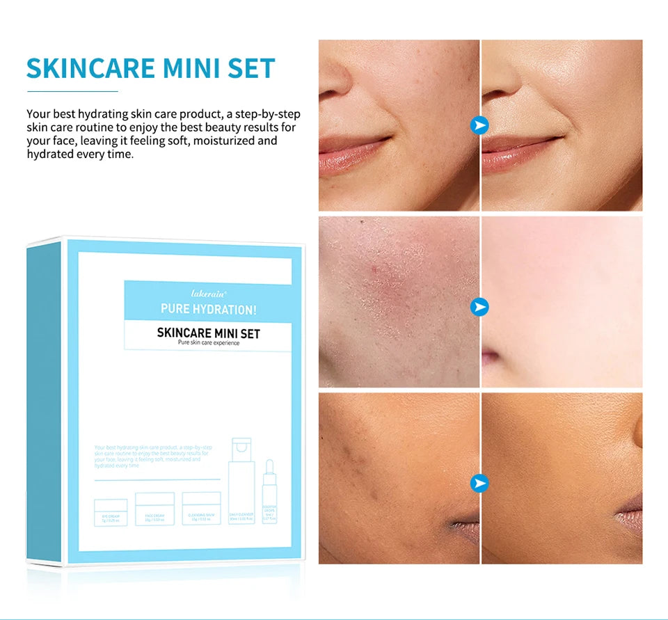 5PCS Skincare Set Hydrate Brighten Firm Skin Exfoliating Acne Removal Shrink Pore Fix Sensitive Dullness Collagen Face Kit