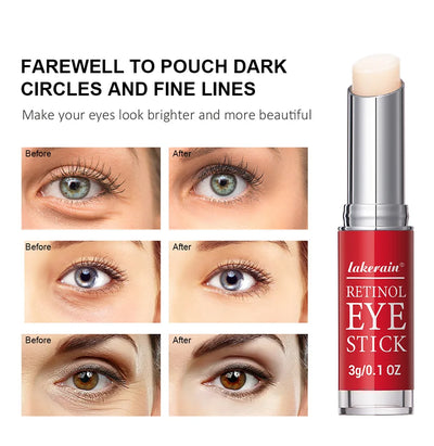 Retinol Eye Cream Stick for Dark Circles and Firming - Smarsty