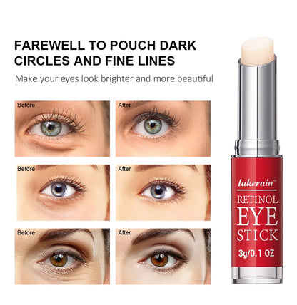 Retinol Eye Cream for Dark Circles and Firming - Smarsty