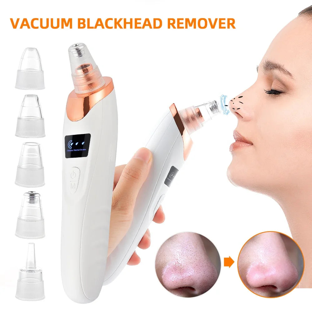 Vacuum Blackhead Remover With USB Charging Convenience - Smarsty