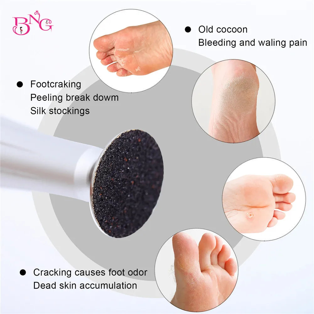 Replaceable Sandpaper Pedicure Discs for Smooth Feet - Smarsty
