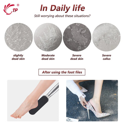 Professional Foot Rasp Replacement Files for Effective Dead Skin Removal - Smarsty