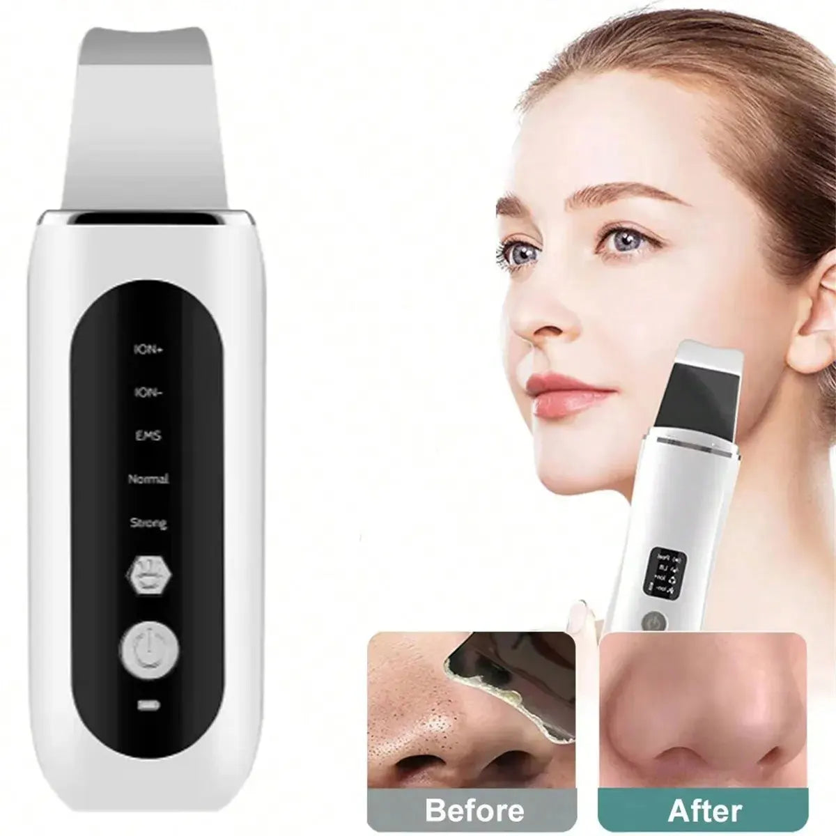 Professional Ultrasonic Face Exfoliator Skin Cleaner Tool - Smarsty
