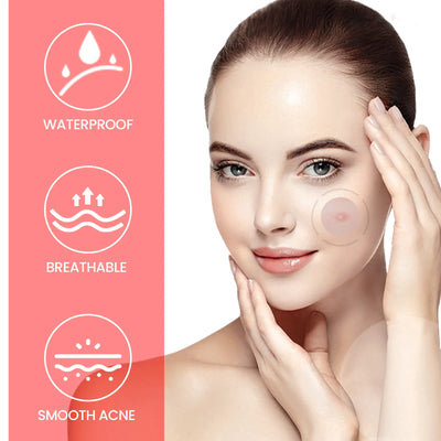 240 pieces of multi-color star acne patches, facial acne patches, concealer acne patches, and pimples patches, ultra-thin - Smarsty