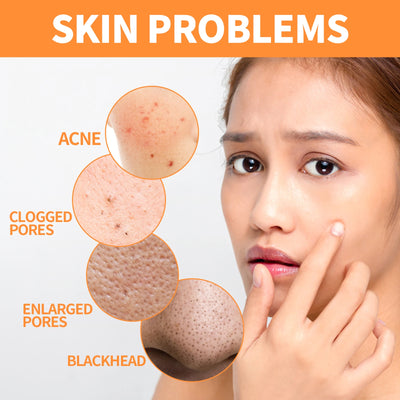 EELHOE Turmeric Skin Care Original Face Cream Serum Oil Stick Mask Body Whitening Anti Acne Lighten Dark Spot Moisturizing