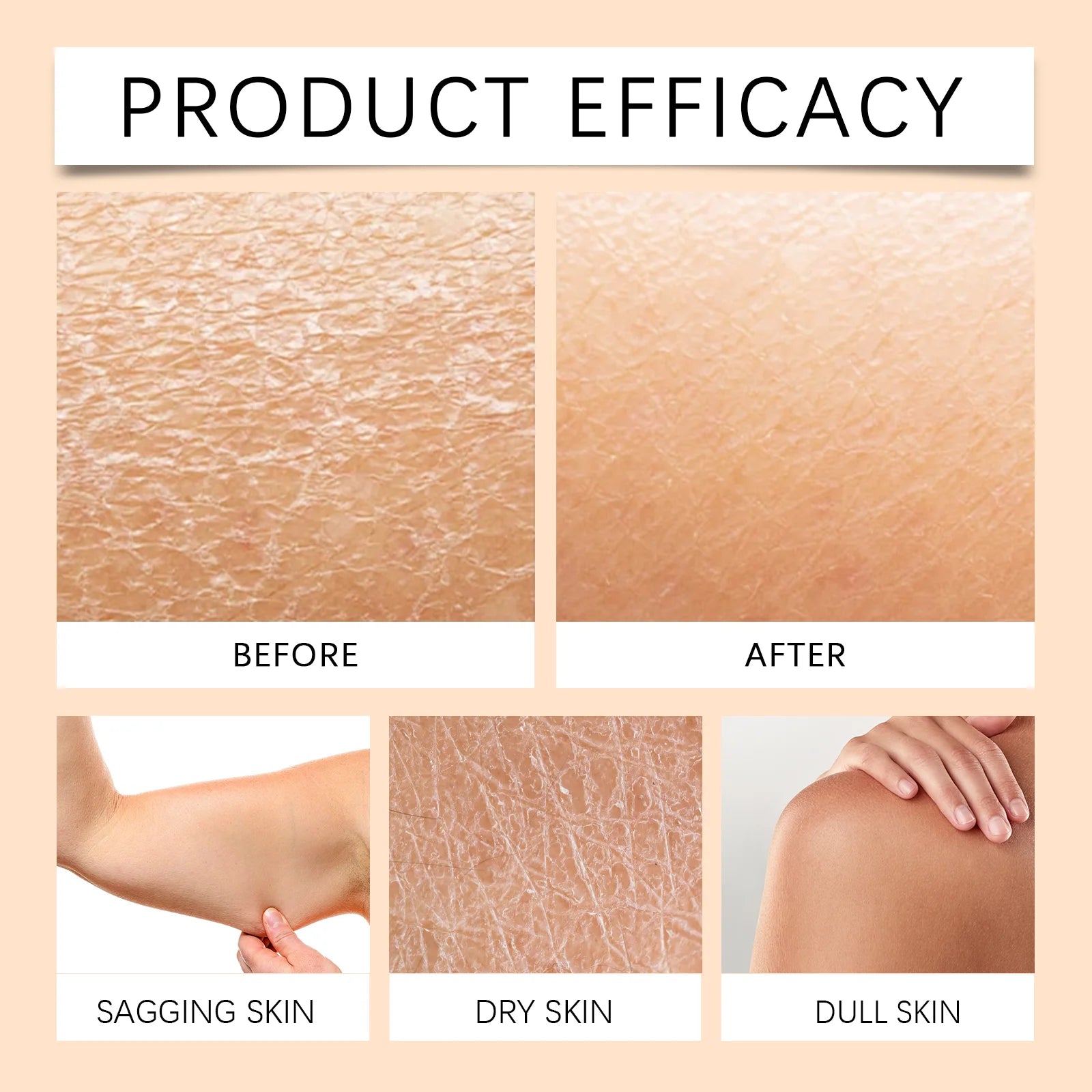 Beef Tallow Body Lotion for Dark Spot Reduction - Smarsty