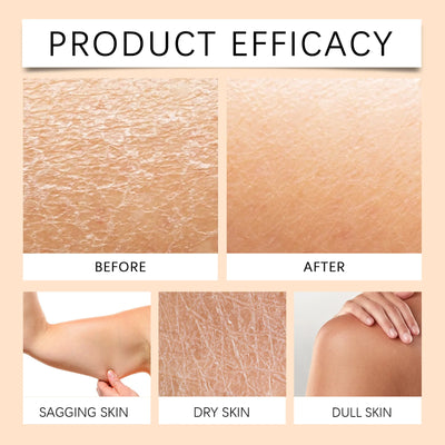 Beef Tallow Body Lotion for Dark Spot Reduction - Smarsty