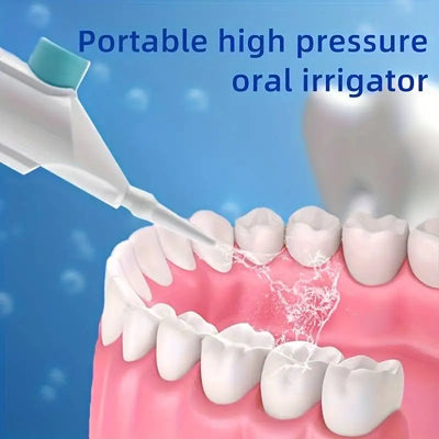 Household High Pressure Oral Irrigator Portable Teeth Clean Water Dental Floss Manual High Pressure Water Toothpick - Smarsty