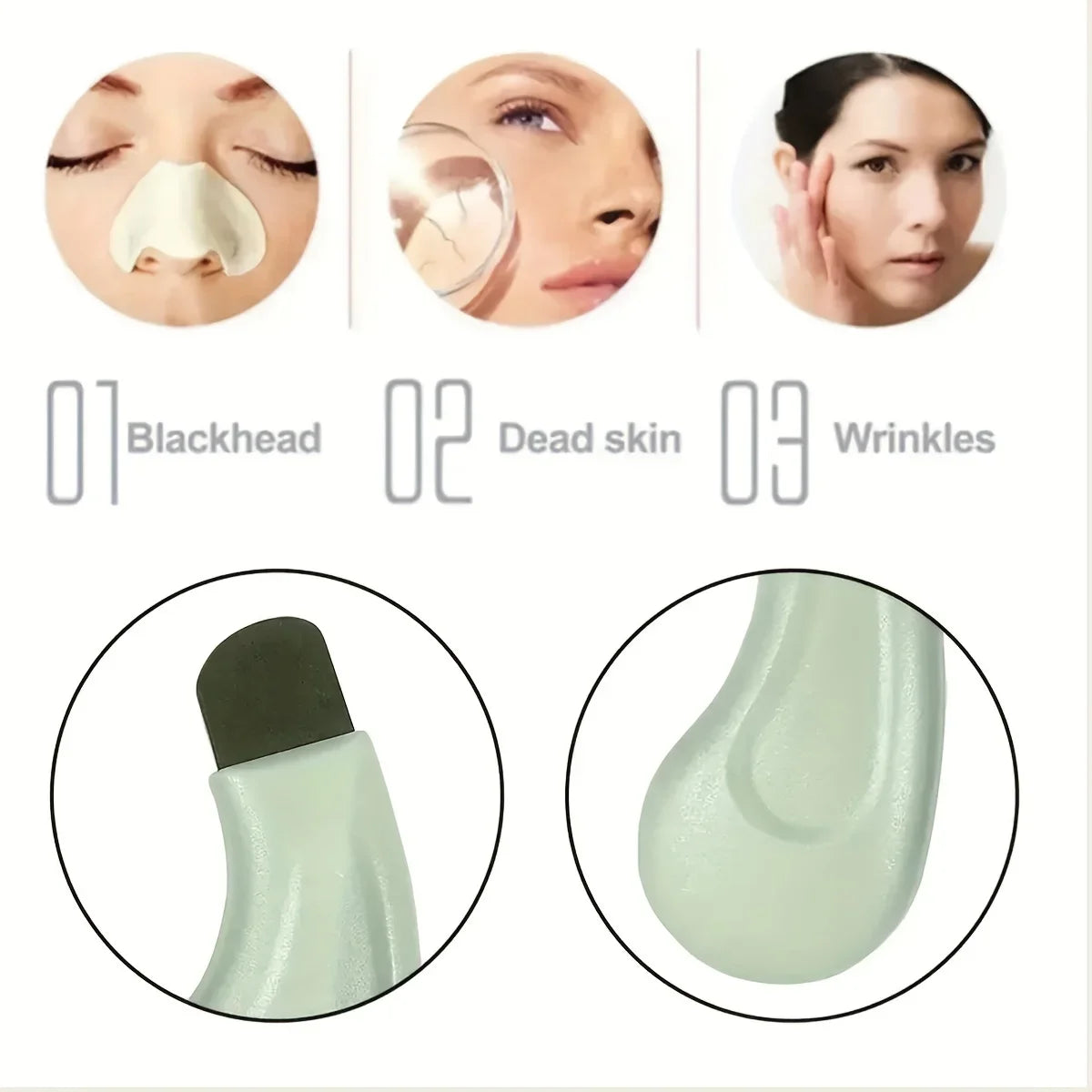 Blackhead and Whitehead Removal Tool for Clear Skin - Smarsty