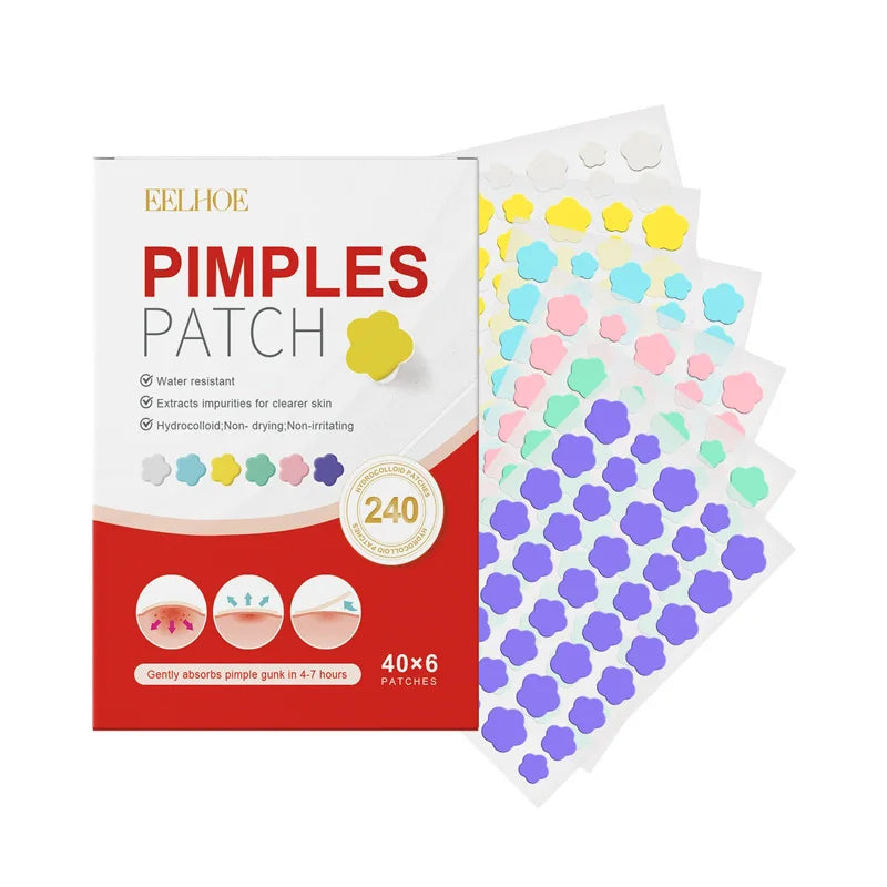 240pcs Star Acne Patches For Effective Spot Treatment - Smarsty