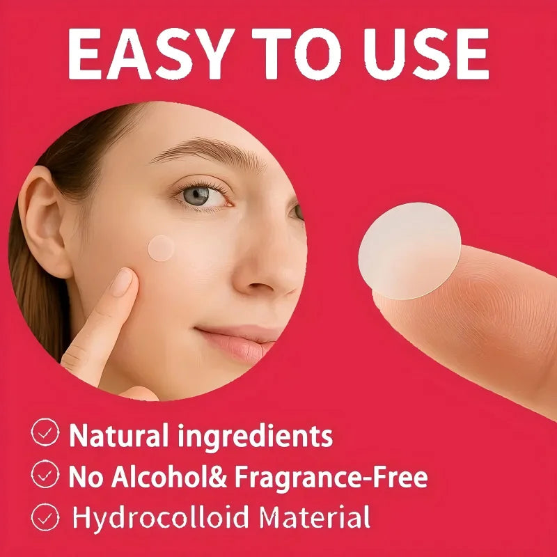 1200 pieces/set of hydrogel patches for acne coverage, suitable for both men and women, suitable for all skin types - Smarsty