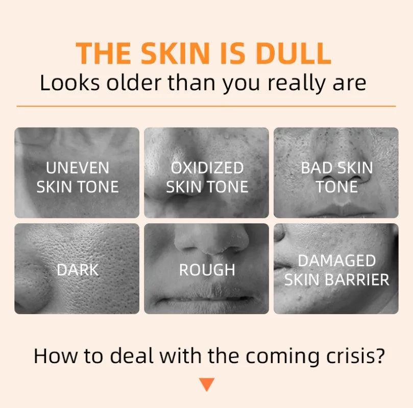 Orange Exfoliating Gel Dead Spot Remover Brighten Peeling 50g Gentle Repair Scrub Whiten Hydrating Moisturizer Korean Skin Care - Smarsty