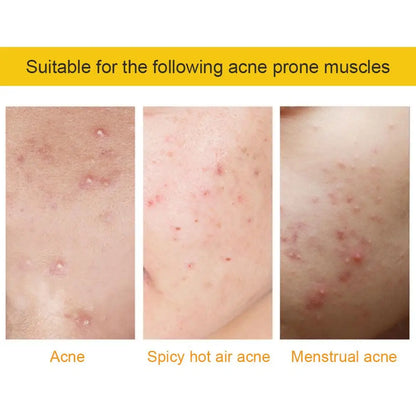 Colorful Star Heart Shaped Acne Pimple Patches - Smarsty