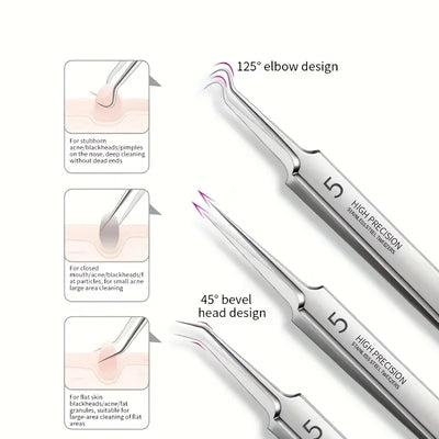 Stainless Steel Blackhead Remover Kit for Clear Skin - Smarsty