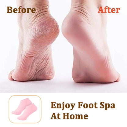 Moisturizing Silicone Foot Socks for Cracked Feet - Smarsty