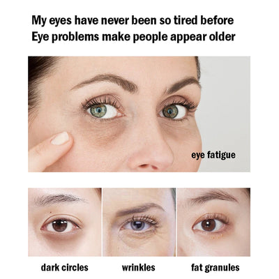 24K Gold Collagen Eye Masks for Dark Circles and Puffiness - Smarsty