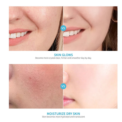 5PCS Skincare Set Hydrate Brighten Firm Skin Exfoliating Acne Removal Shrink Pore Fix Sensitive Dullness Collagen Face Kit