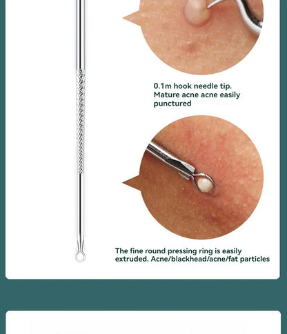 4 Piece Acne Blackhead Removal Needle Set - Smarsty