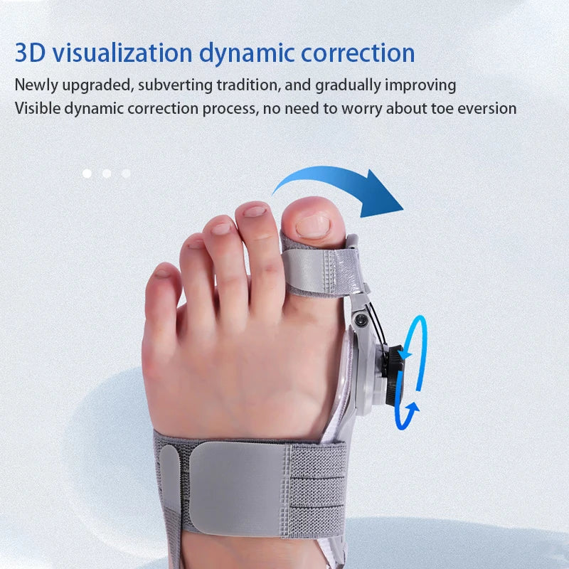 Bunion Corrector Adjustable Hallux Valgus Toe Separator - Smarsty