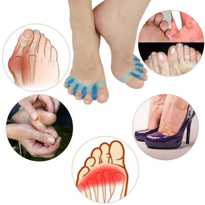 Soft Gel Bunion Corrector Toe Separator Spacers - Smarsty
