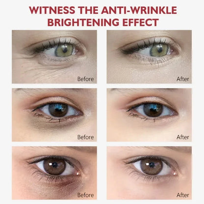 Nicotinamide Eye Cream for Dark Circles and Puffiness - Smarsty