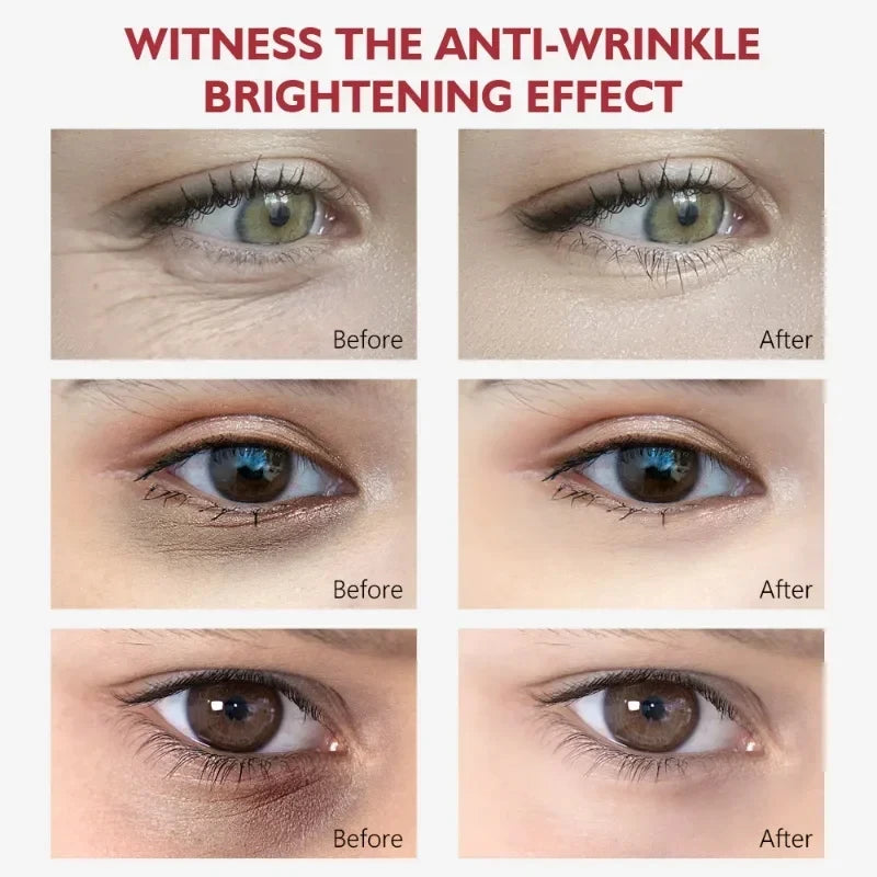 Nicotinamide Eye Cream for Dark Circles and Puffiness - Smarsty