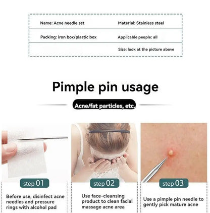 4 Piece Acne Blackhead Removal Needle Set - Smarsty