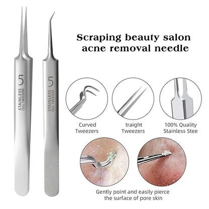 German Ultra Fine Blackhead Remover Tool for Clear Skin - Smarsty
