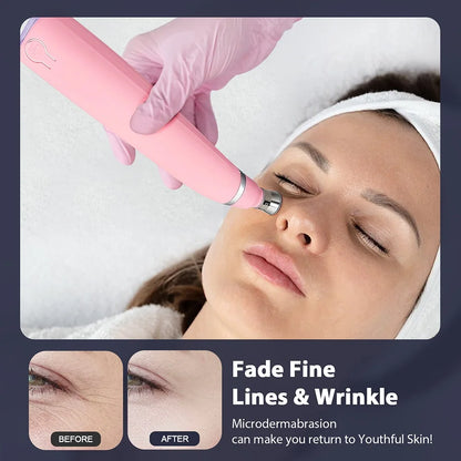 Professional Diamond Microdermabrasion Machine for Home Use - Smarsty