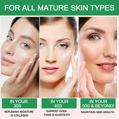 Nicotinamide Eye Cream for Dark Circles and Puffiness - Smarsty