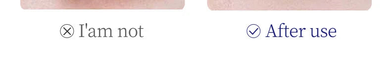 SADOER Collagen Eye Cream for Dark Circles and Puffiness - Smarsty