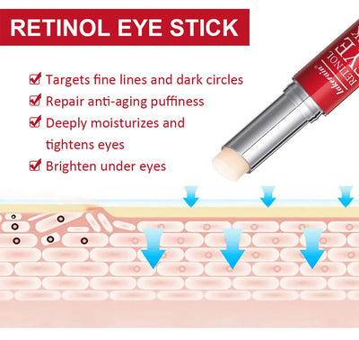 Retinol Eye Cream Stick for Dark Circles and Firming - Smarsty