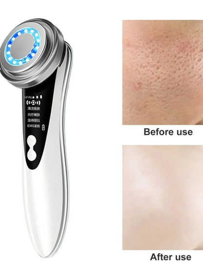 5 In 1 Facial Massager with LED Light Therapy - Smarsty