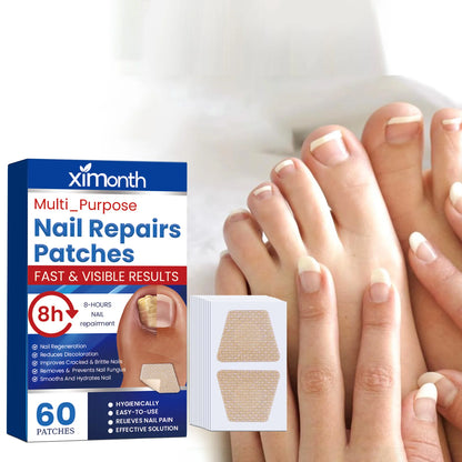 Nail Repair Patches for Toenail Fungus Relief - Smarsty