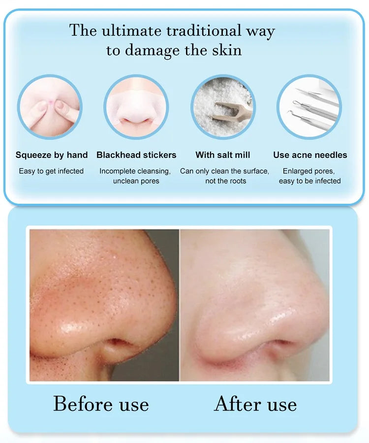 Face Cleansing Beauty Machine with Suction Modes - Smarsty