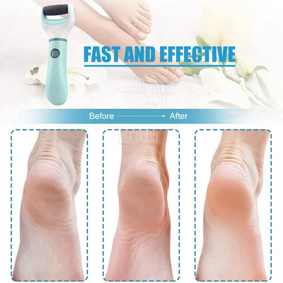 Electric Foot Grinder for Painless Dead Skin Removal - Smarsty