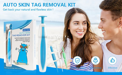 3 In 1 Painless Skin Tag Removal Kit - Smarsty