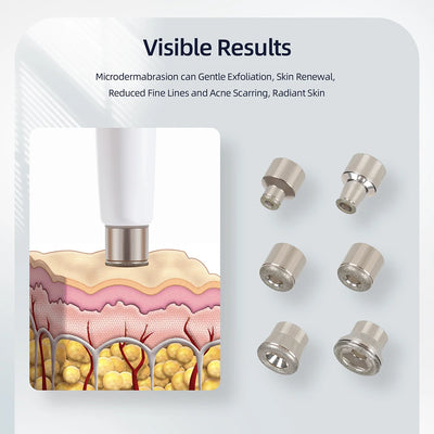 Professional Diamond Microdermabrasion Machine for Home Use - Smarsty