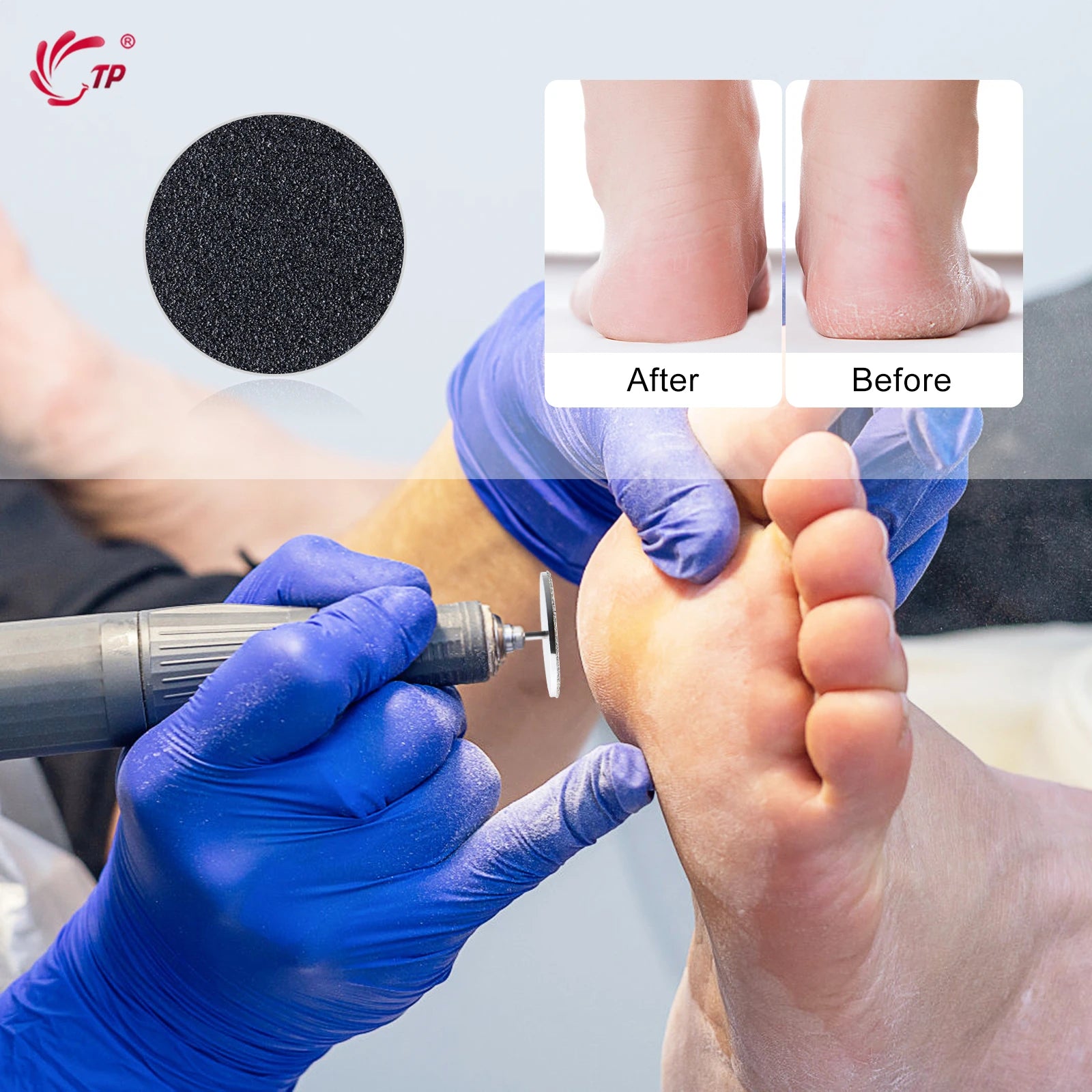 Pedicure Sandpaper Discs for Dead Skin Removal - Smarsty