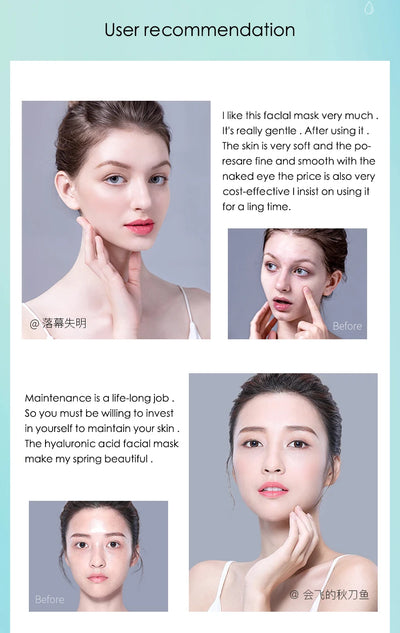 Hyaluronic Acid Hydrating Facial Mask 10 Pack - Smarsty