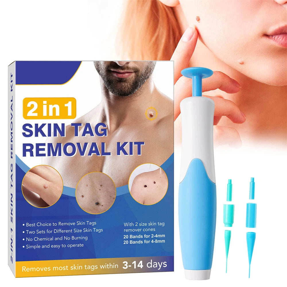 2 In 1 Painless Skin Tag Removal Kit for Face and Body - Smarsty