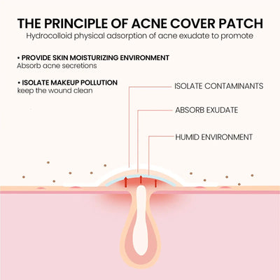 240 pieces of multi-color star acne patches, facial acne patches, concealer acne patches, and pimples patches, ultra-thin - Smarsty